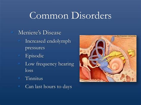 Ppt Vestibular Rehabilitation Evaluation And Treatment Strategies