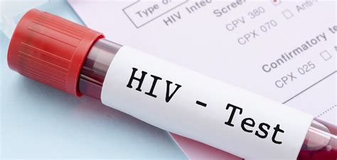 Cdc Revises Hiv Testing Guidelines To Better Id Early Cases Poz
