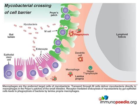 Mycobacterium Avium Complex Case Study Immunopaedia