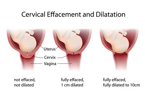 Your Dilating Cervix The Gateway To Babys Birth The Pulse