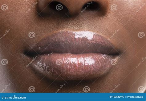Perfecte Pomplippen Van Zwarte Vrouw Na Vullende Injecties Stock Afbeelding Image Of Mooi