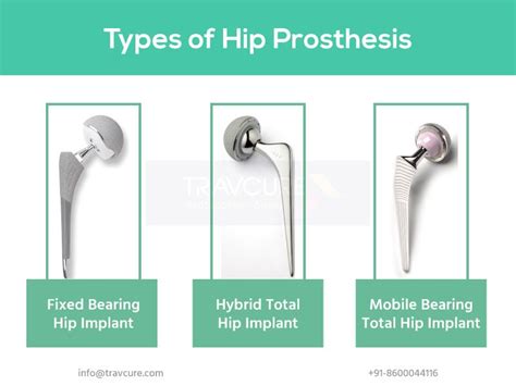 Total Hip Replacement Types