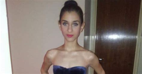 Astonishing Recovery Of Anorexic Girl Who Was 5 Stone When Doctors Told