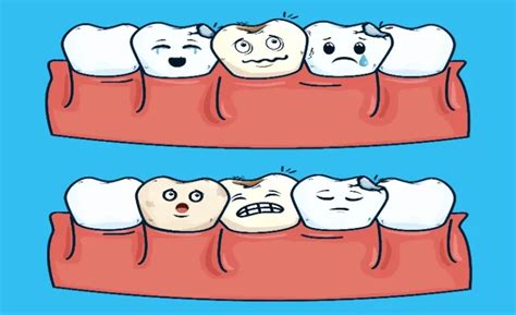 Prevent And Treat Gum Line Cavities Effectively