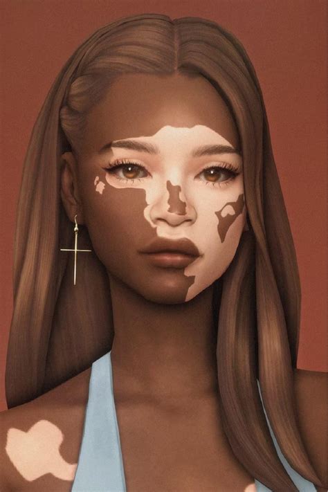 Sims 4 Vitiligo Skin Cc Mods Download 2024 All Free Artofit