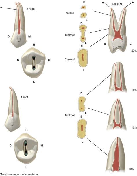 Pulpal Anatomy And Access Preparations Pocket Dentistry