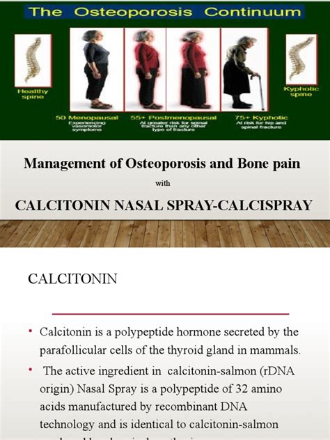 Management Of Osteoporosis And Bone Pain Calcitonin Nasal Spray Calcispray Pdf Osteoporosis