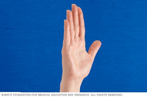 Slide Show Hand Exercises For People With Arthritis Mayo Clinic