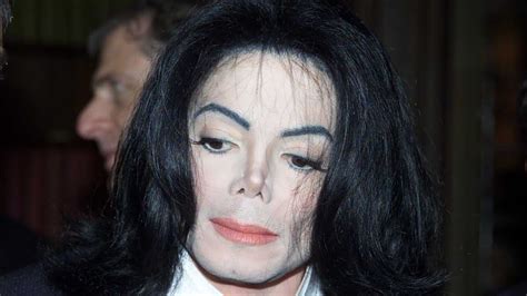 Michael Jackson Y Algunos Famosos Que Aprendieron A Vivir Con Vitíligo