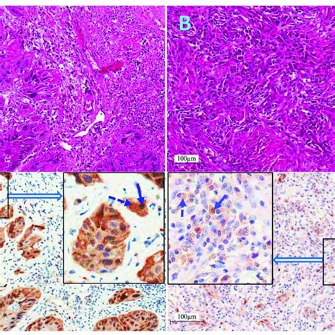 Descriptive Statistics Of 285 Head And Neck Squamous Cell Carcinoma