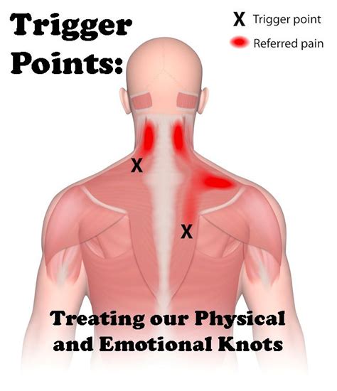 Pin On Acupressure Points And Trigger Points