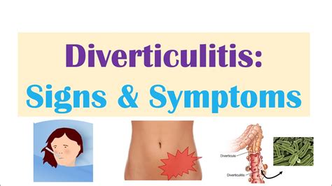 Diverticulum Symptoms Hot Sex Picture