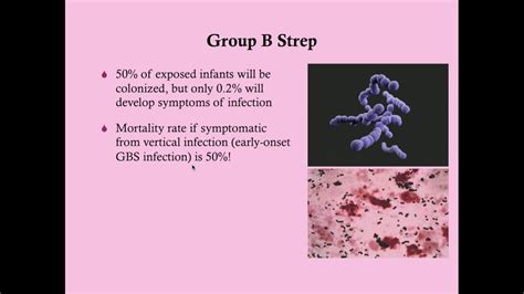 Group B Strep In Pregnancy Crash Medical Review Series Youtube
