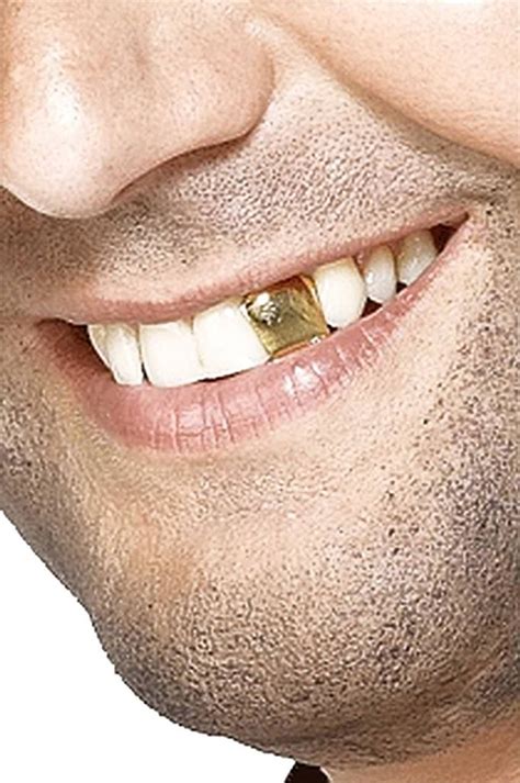 Gold Miner Teeth Ubicaciondepersonascdmxgobmx