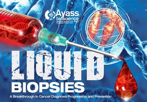 Liquid Biopsies High Sensitivity Cancer Detection Ayass Bioscience
