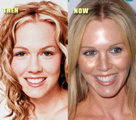 Jennie Garth Plastic Surgery Before And After Plastic Surgery