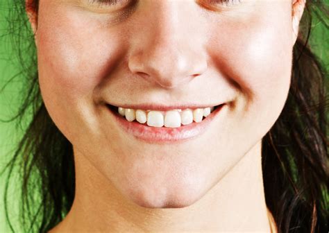 How To Get Rid Of Chin Dimples With Anti Ageing Treatments Kp