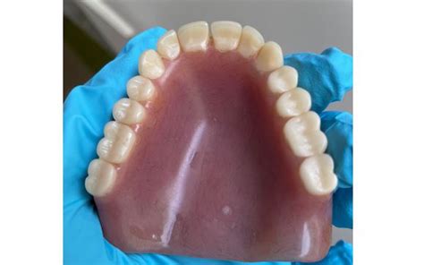 Dentures And Partial Dentures By Ja Lewandowski Dds In Leawood Ks