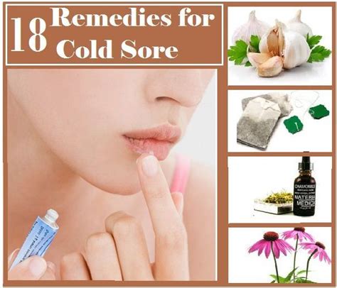 Home Remedies For Cold Sore Cold Home Remedies Cold Sores Remedies