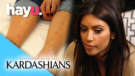 Kim Diagnosed With Psoriasis Keeping Up With The Kardashians Youtube