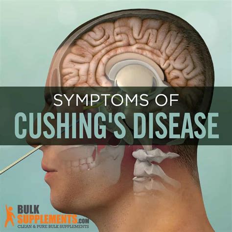 Cushings Disease Symptoms Causes And Treatment