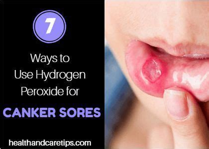 Some people bust open vitamin e capsules to put on it, but that might be difficult since it's in the back of your throat. How Can We Use Hydrogen Peroxide for Canker Sores - TOP 7 ...