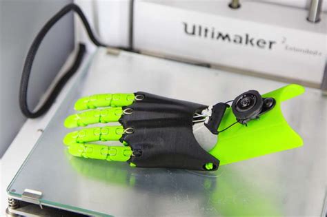 Nu Team To Research Design Next Generation Of 3d Printed Prostheses