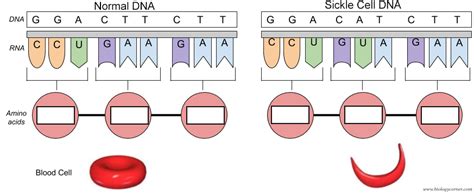 The Genetics Of Sickle Cell Anemia
