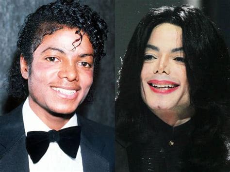 10 Before And After Celebrity Plastic Surgery Fails That ...