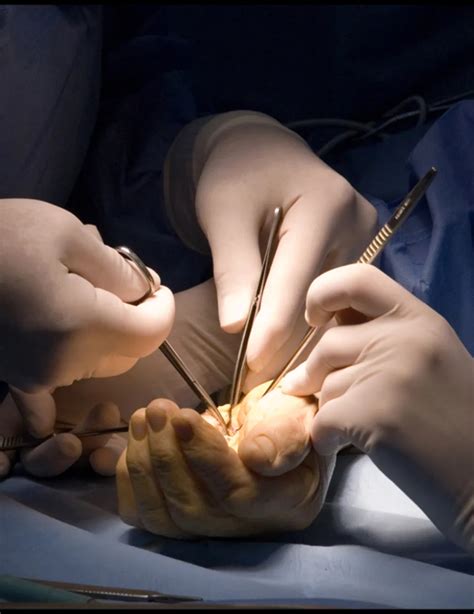 Carpal Tunnel Surgery In Adelaide Adelaide Neurosurgery Centre