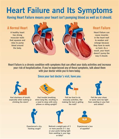 Congestive Heart Failure Causes And Types Jugaadin News