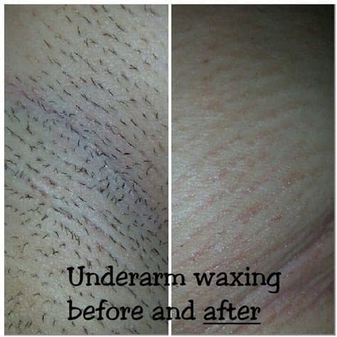 Should you shave your armpit hair? Waxing. Before and after with nufree wax | Body waxing ...