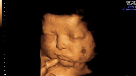 4d Baby Scan At Wiltshire Call 08000075076 Baby Moments