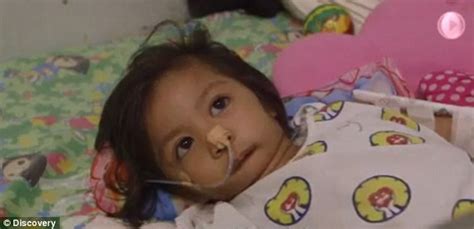 Filipino Girl Born With A Sealed Mouth Goes Under The Knife Daily