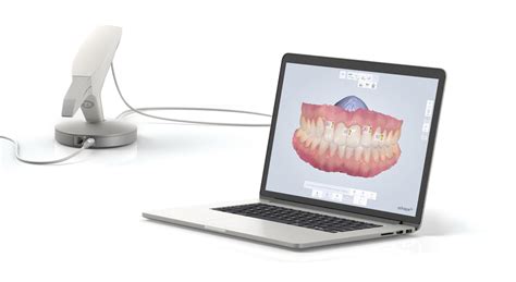 la numérisation 3d cfao dentaire scanner dentaire 3d