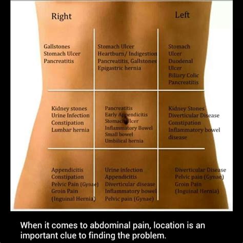Location Of Abdominal Pain Healthexercisesnutrition