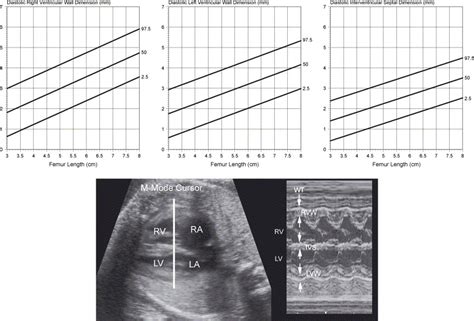 Assessing Fetal Cardiac Ventricular Function Seminars In Fetal And