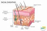 What Medical Conditions Cause Excessive Sweating Images