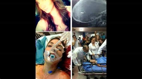 Fallece Génesis Carmona Reina De Belleza Herida Durante Manifestaciones En Venezuela Youtube