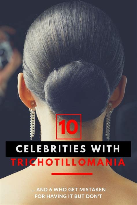 12 Famous People With Trichotillomania And The 6 That Really Dont