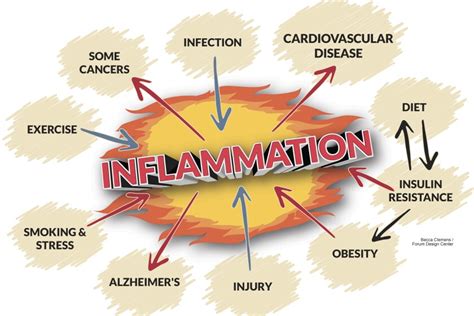 The Good News And Bad News Of Inflammation Duluth News Tribune