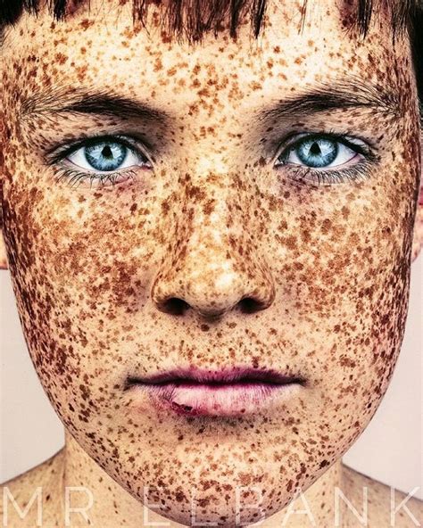 Stunning Portraits Celebrate The Unique Beauty Of Freckled Faces