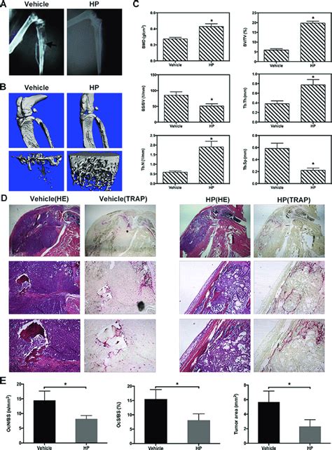 Hypericin Reduces Osteolysis And Preserves Trabecularcancellous Bone