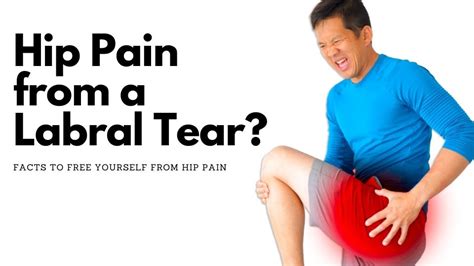 Hip Labral Tears What You Need To Know And What Your Doctor Wont Say