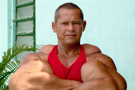real life popeye s huge arms from oil injections
