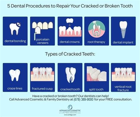 5 Dental Procedures To Repair Your Cracked Or Broken Tooth