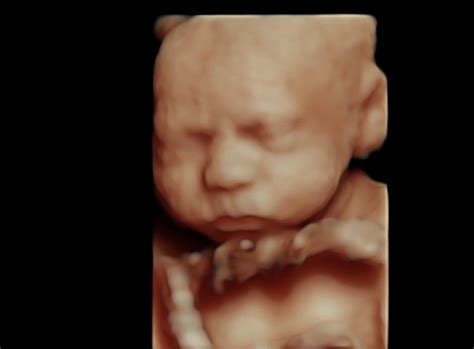 Eight Benefits Of 4d Ultrasounds Lollipop 4d Baby Scans