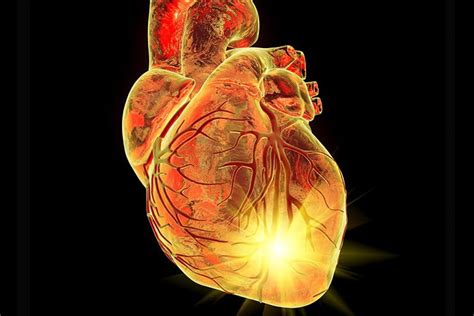 Escalating And De Escalating Temporary Mechanical Circulatory Support