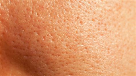 How To Get Rid Of Pores Tips And Products To Shrink Your Pores Glamour Uk