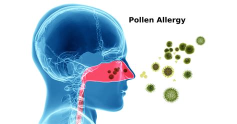 Pollen Allergy Symptoms Causes Prevention And Treatments